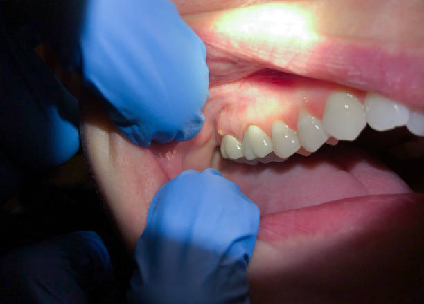 Best Emergency Denture Repair in Kingsville, TX